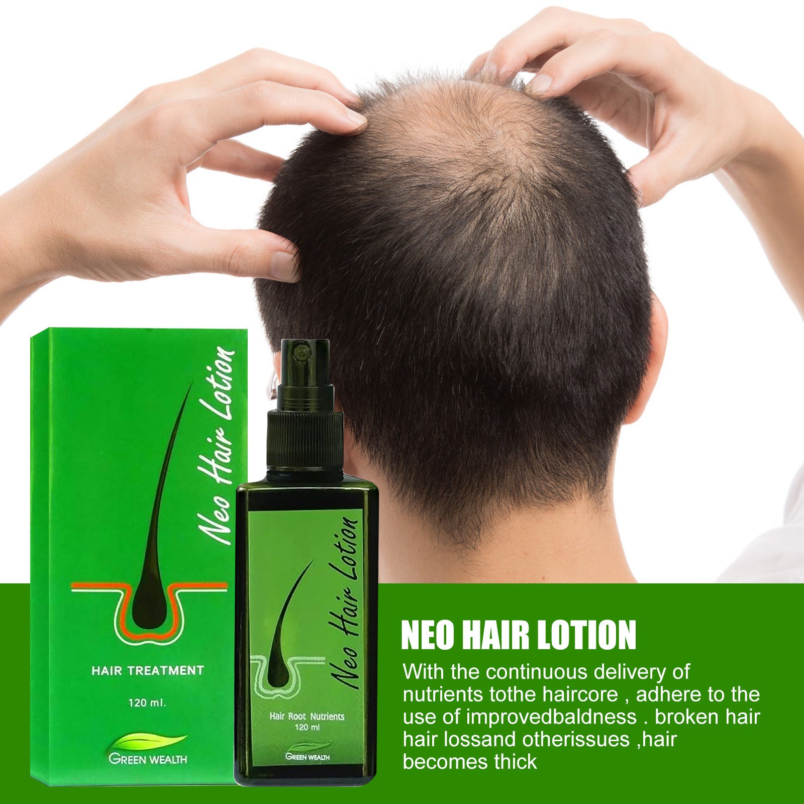 Hair Care Growth Lotion Spray Hair Care Growth Lotion Spray